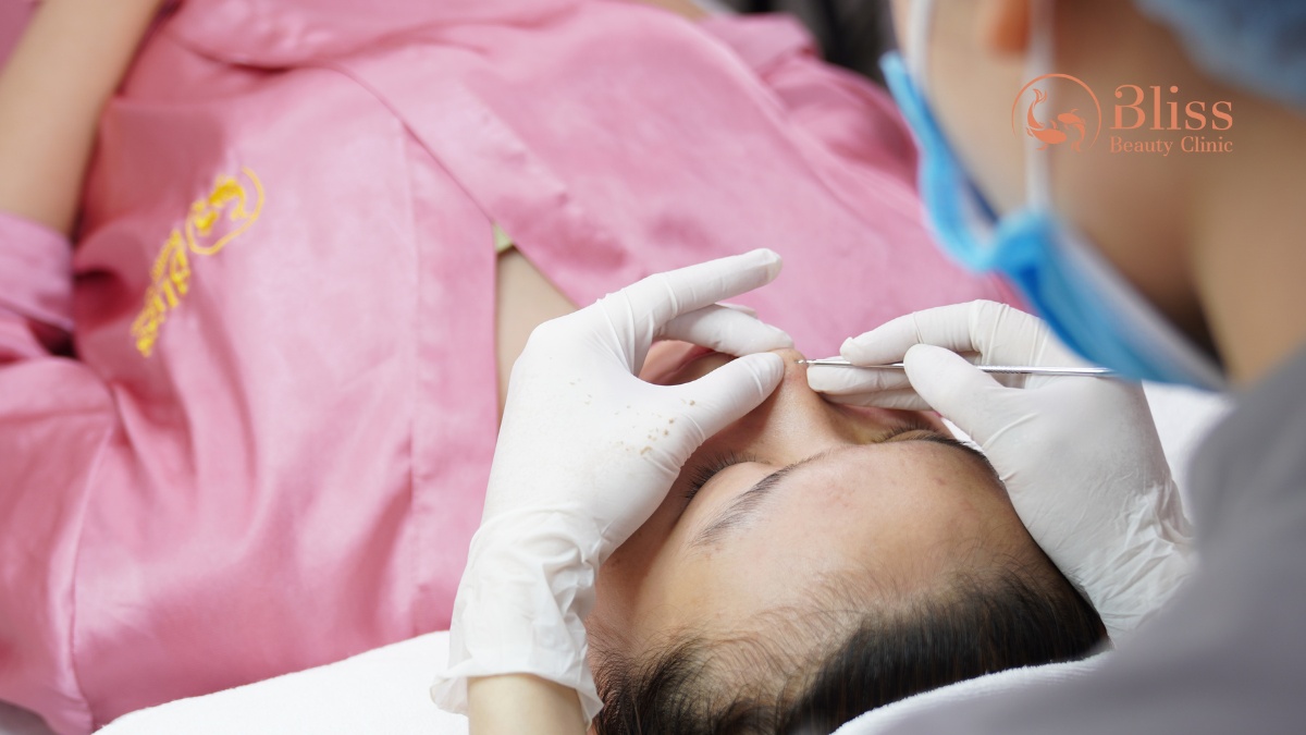 lấy nhân mụn 15 bước chuẩn y khoa