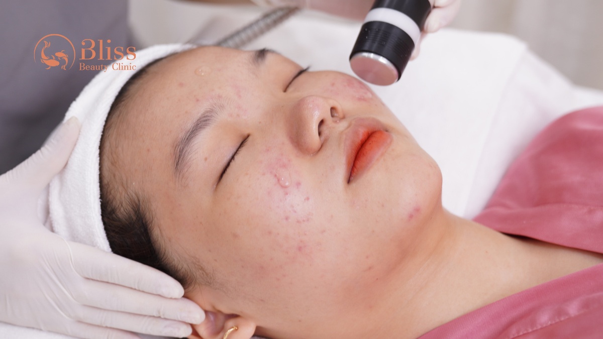 lấy nhân mụn 15 bước chuẩn y khoa