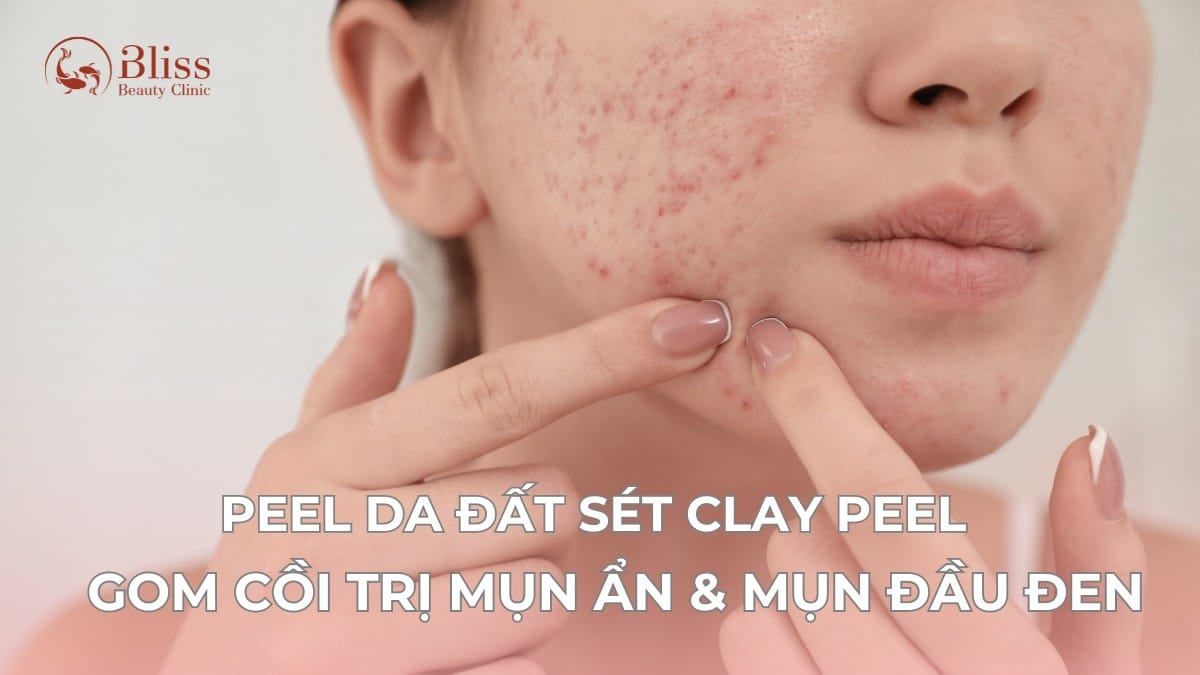 Peel da đất sét Clay Peel 