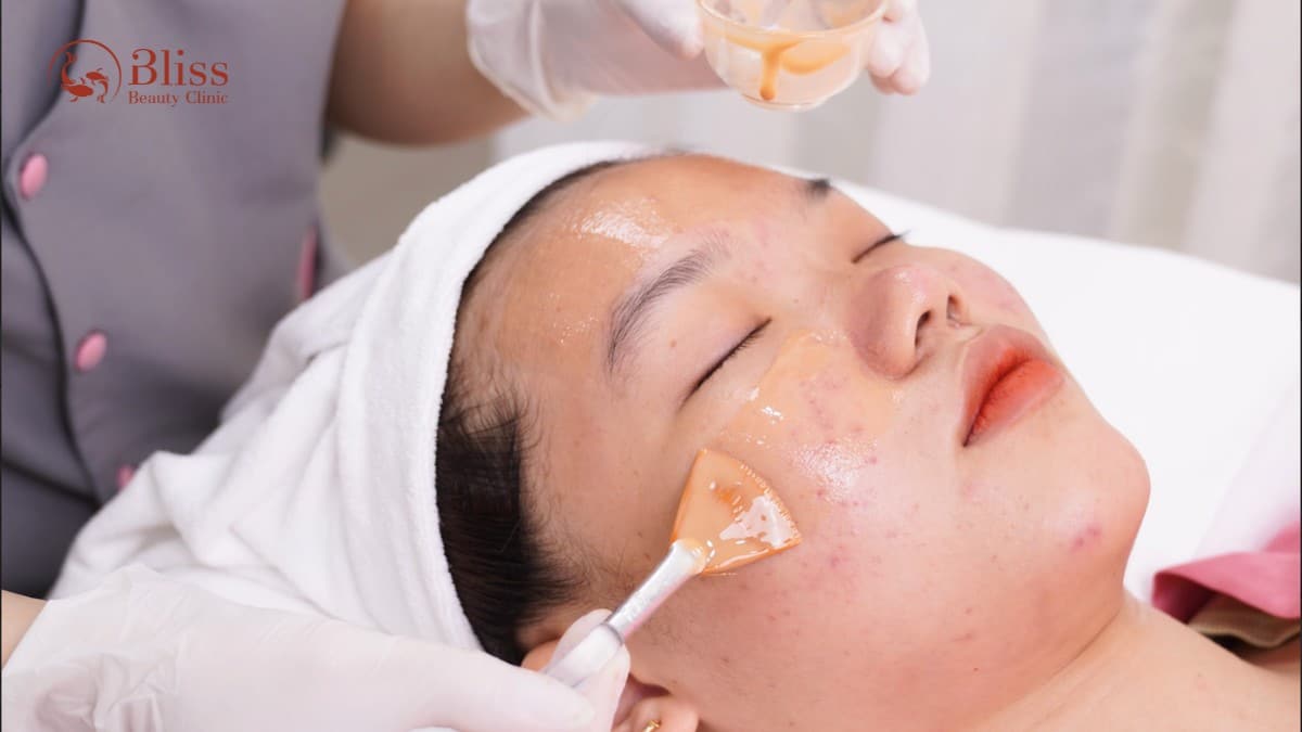 Peel da đất sét Clay Peel 