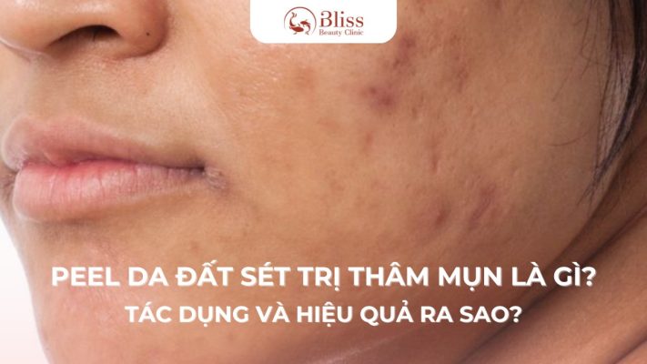 peel-da-dat-set-tri-tham-mun-la-gi-tac-dung-va-hieu-qua-ra-sao