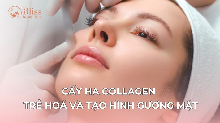 cấy HA Collagen trể hoá và tạo hình gương mặt