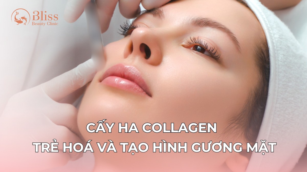 cấy HA Collagen trể hoá và tạo hình gương mặt