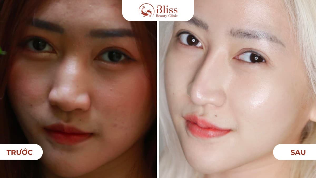 hiệu quả khách hàng