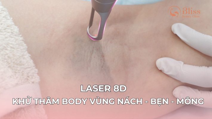 Laser 8D khử thâm body