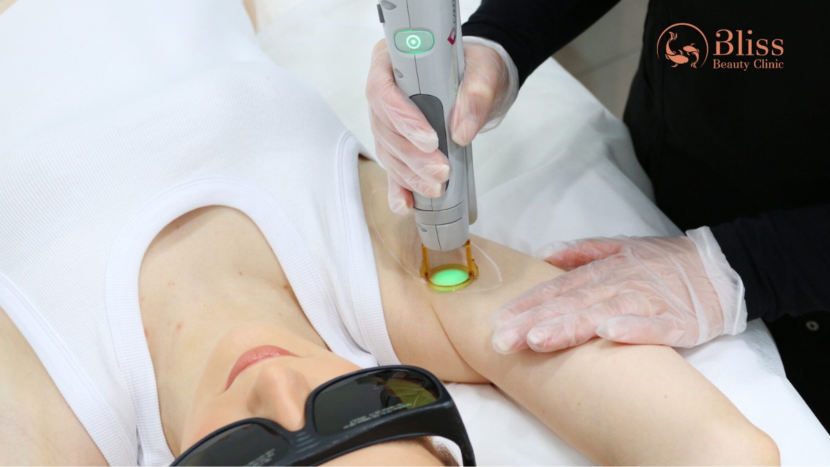 Laser 8D khử thâm nách bẹn mông