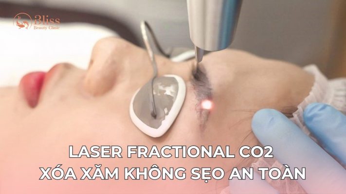 Laser CO2 Fractional xóa xăm