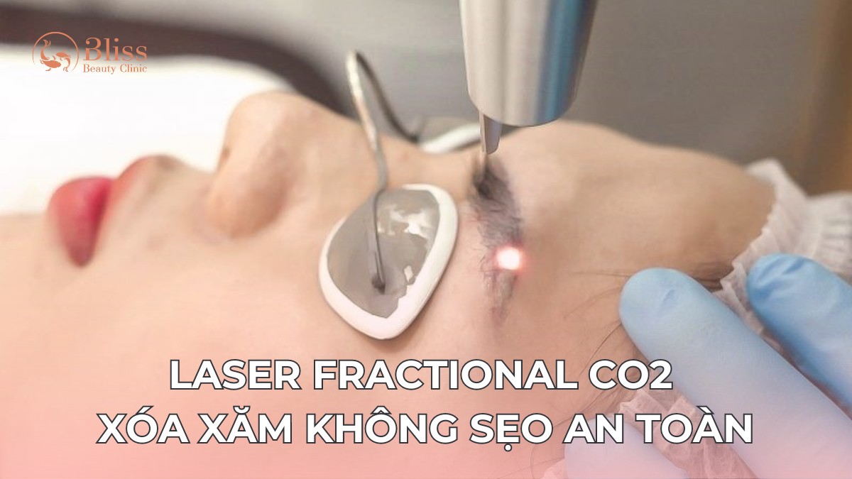 Laser CO2 Fractional xóa xăm