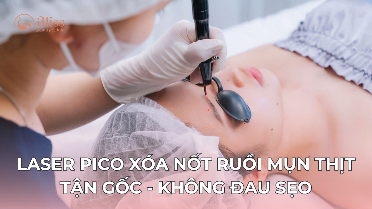 Laser Pico xóa nốt ruồi mụn thịt tận gốc