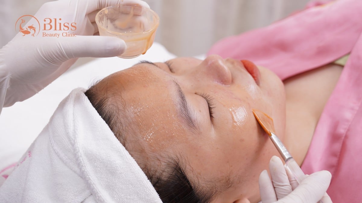 clay peel gom cồi giảm mụn