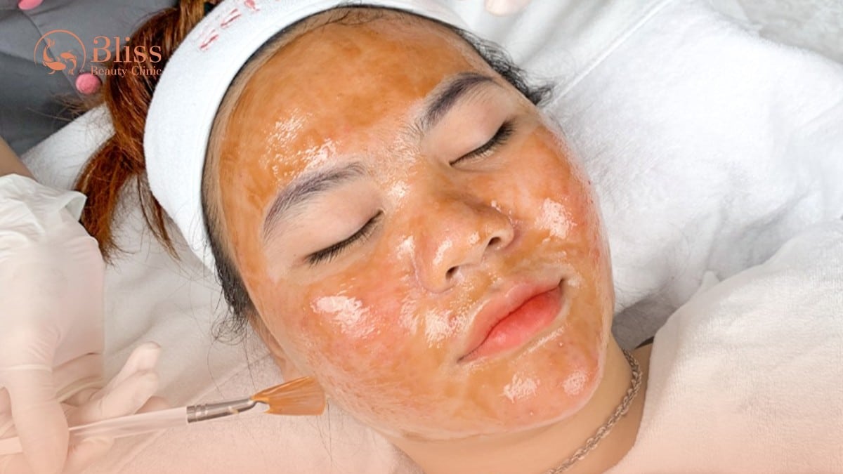 peel da đất sét clay peel