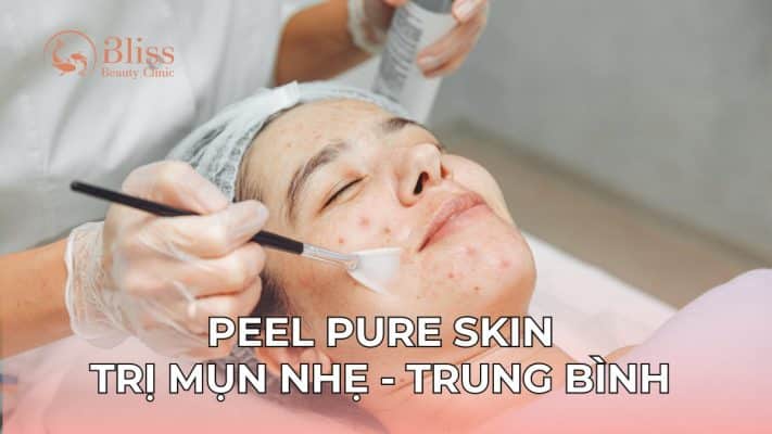 pure skin trị mụn viêm nhẹ