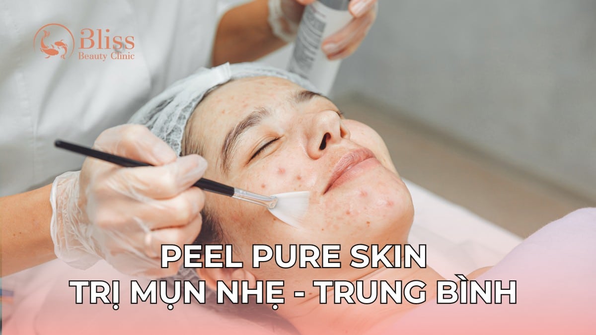 pure skin trị mụn viêm nhẹ