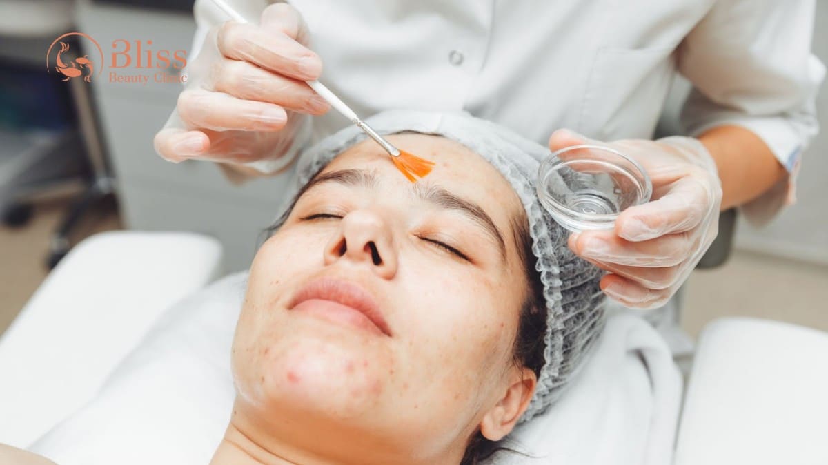 pure skin trị mụn viêm nhẹ - trung bình