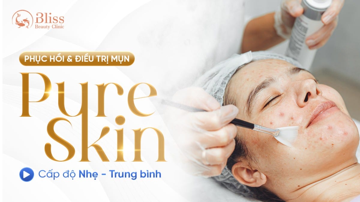 pure skin trị mụn viêm nhẹ - trung bình
