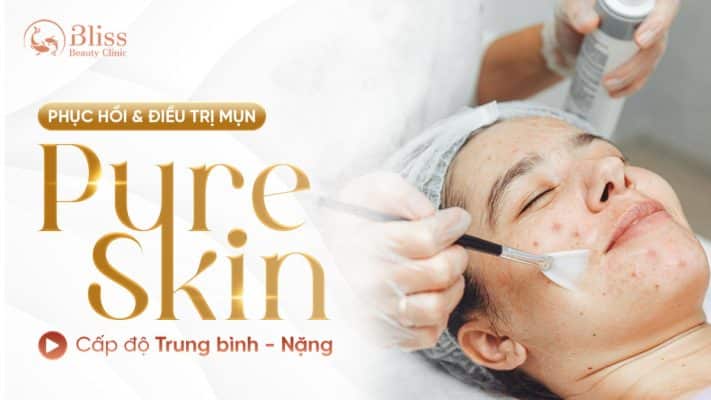 pure skin trị mụn viêm nặng