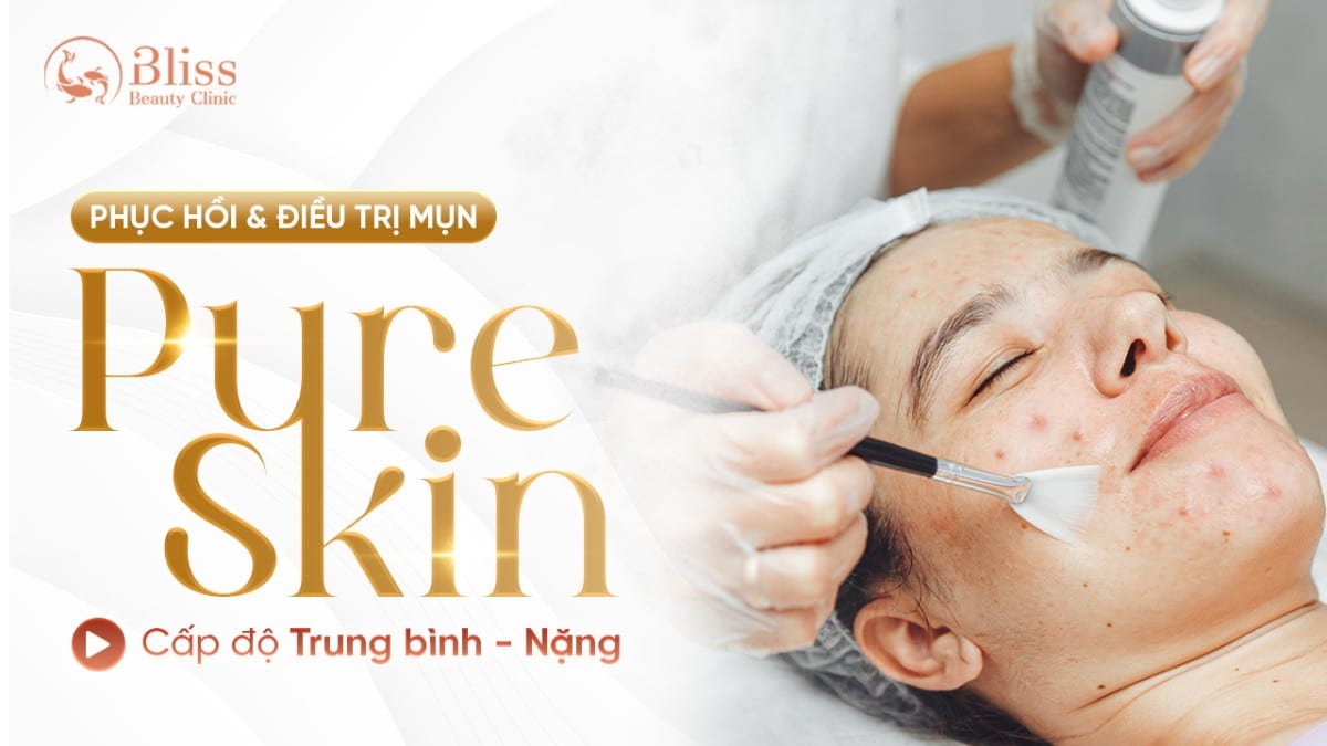pure skin trị mụn viêm nặng