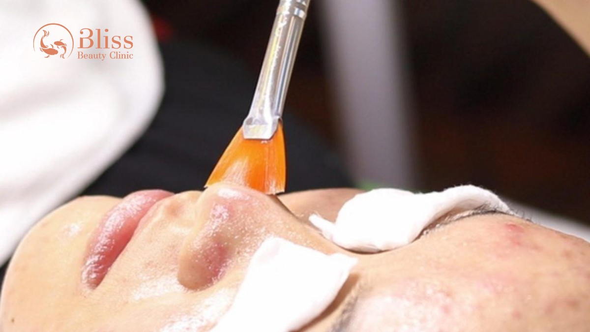 pure skin trị mụn viêm nặng