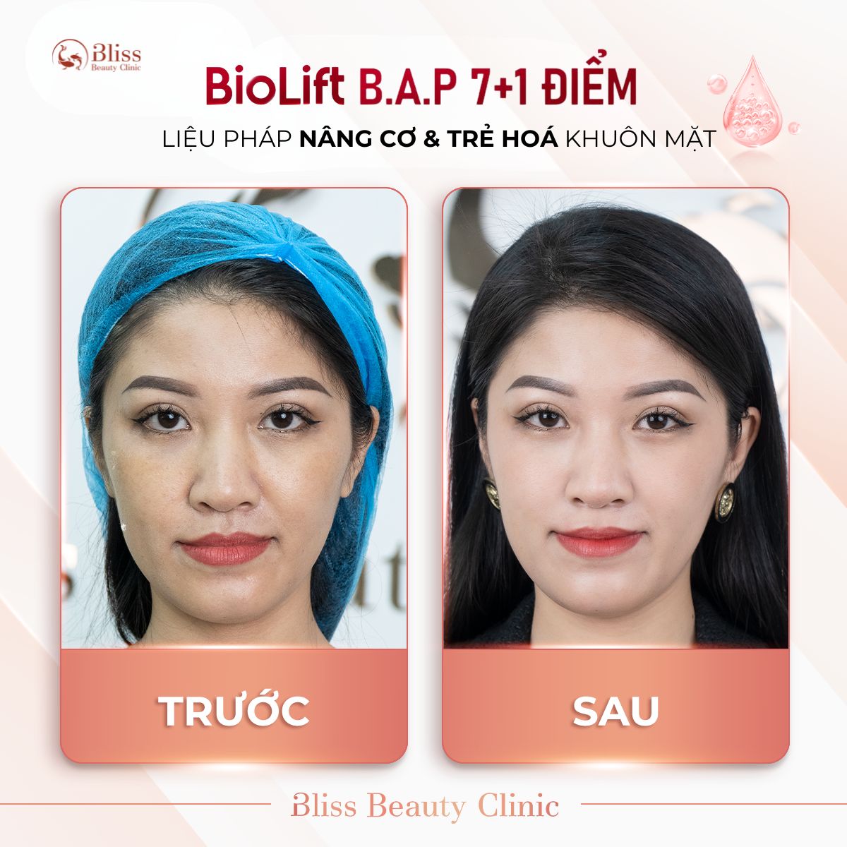 BioLift BAP 7+1 điểm