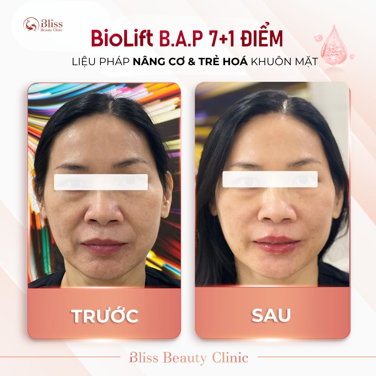 BioLift BAP 7+1 điểm
