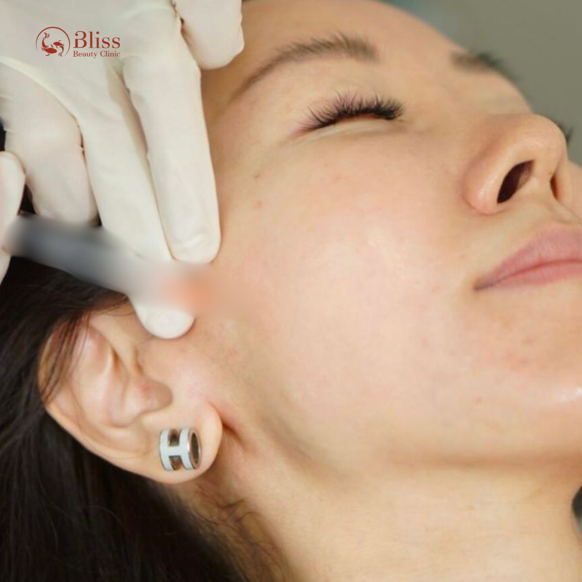 BioLift BAP 7+1 điểm