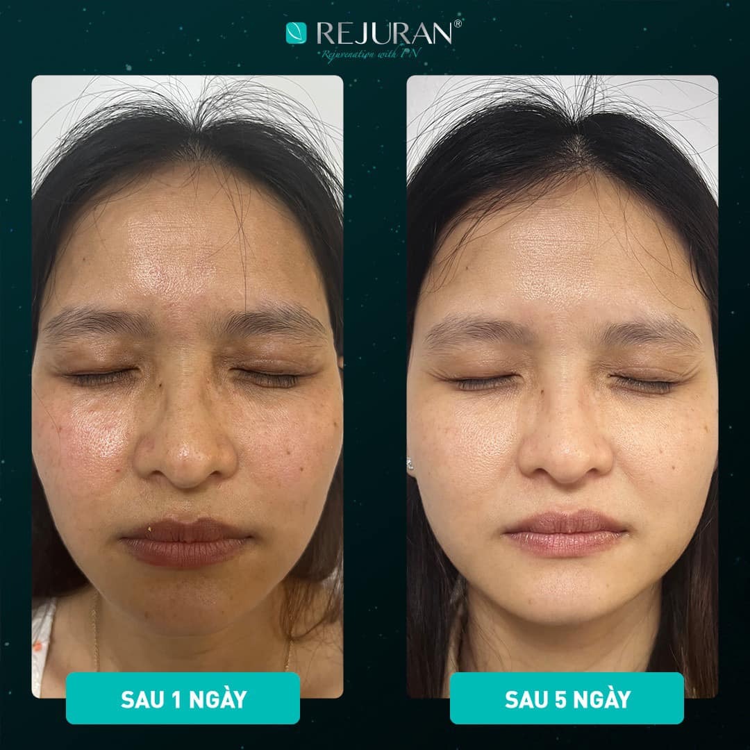 hiệu quả khách hàng rejuran