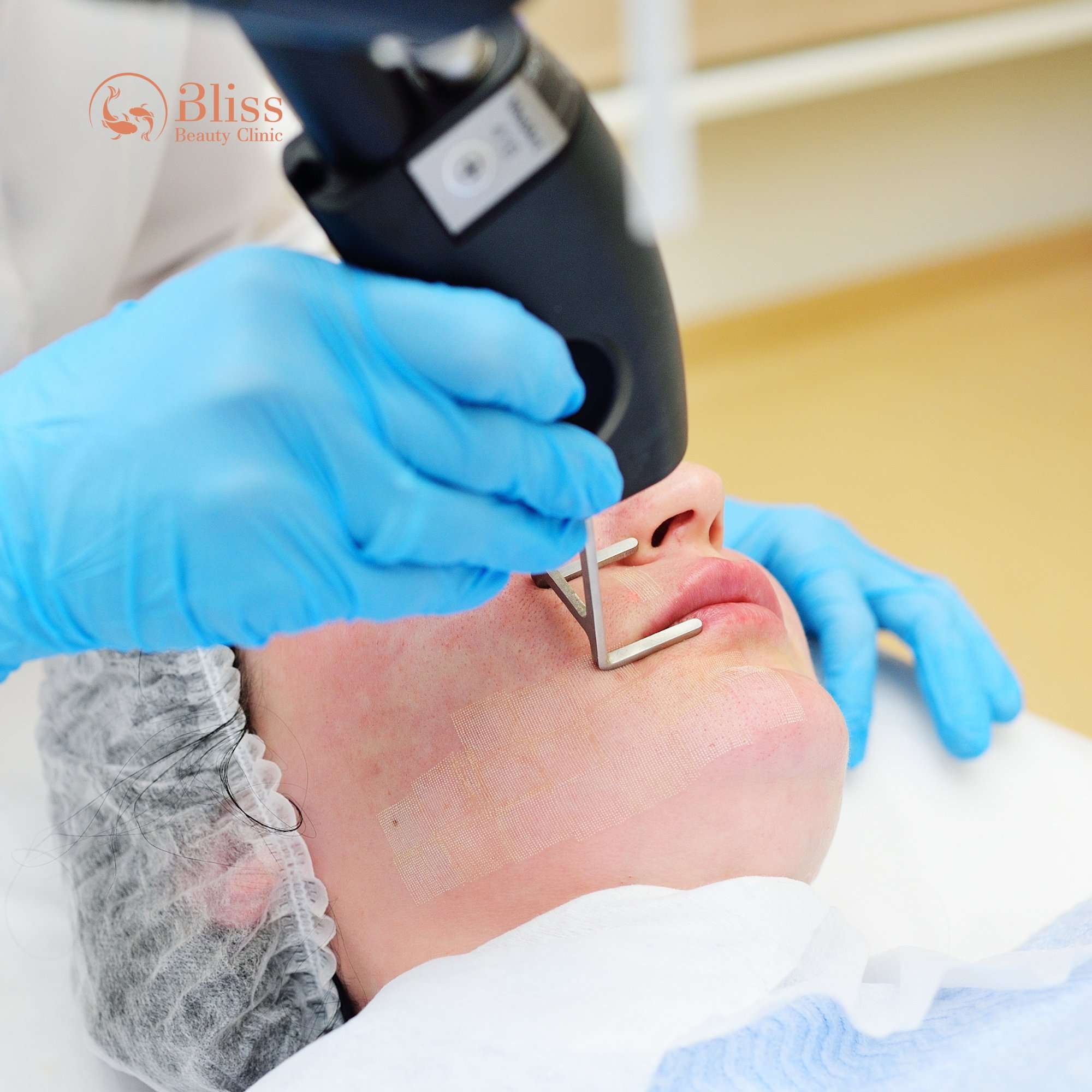 So sánh trị mụn Hydrogen với các phương pháp khác