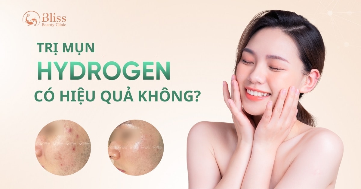 trị mụn hydrogen có hiệu quả không
