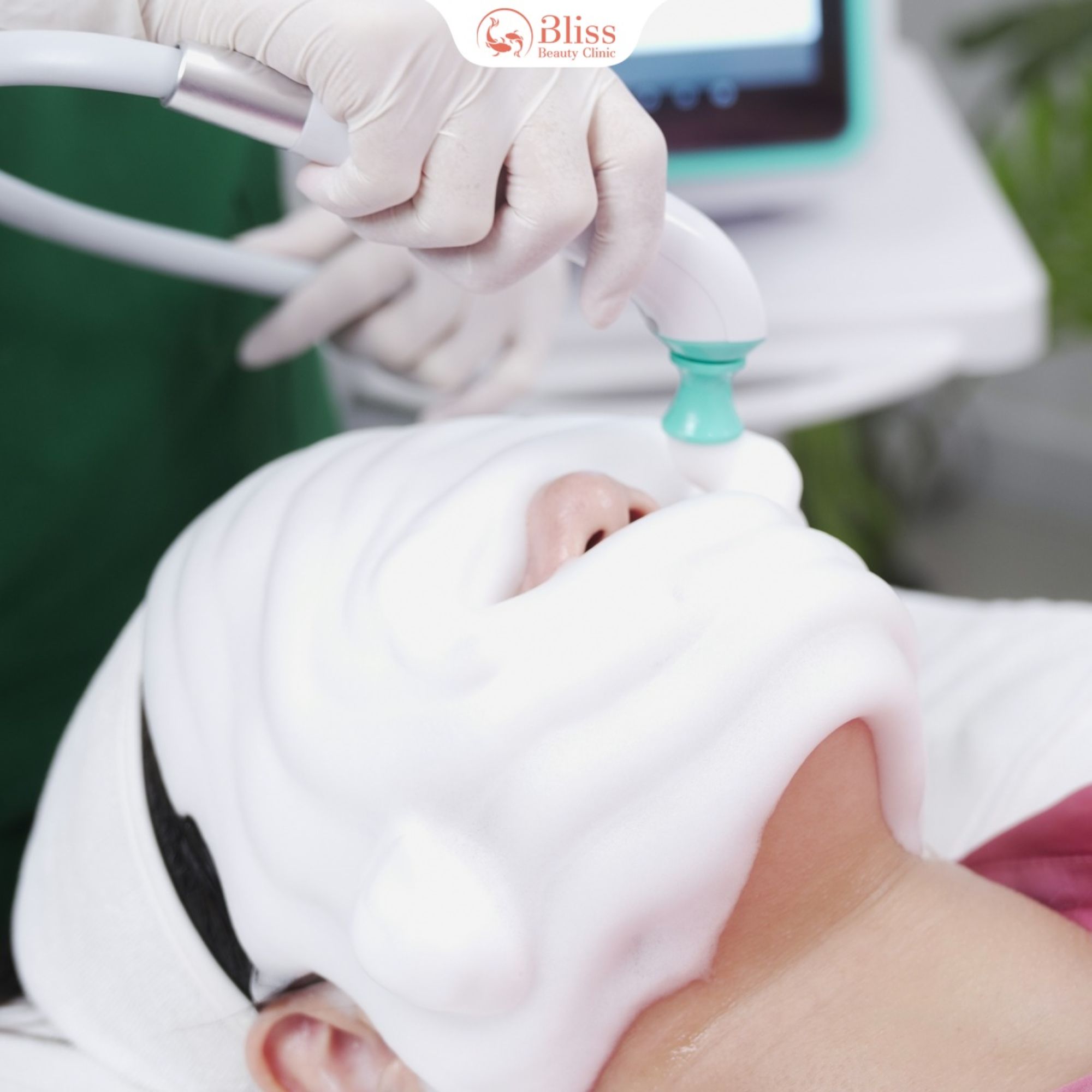 trị mụn Hydrogen có tái phát không