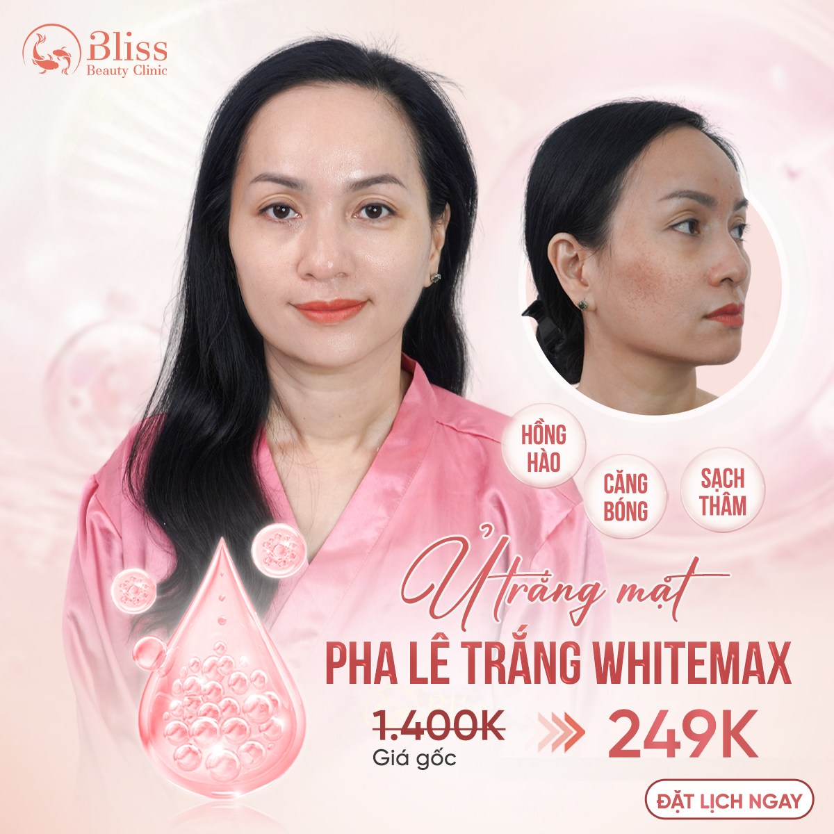 Ủ trắng WhiteMax là gì?