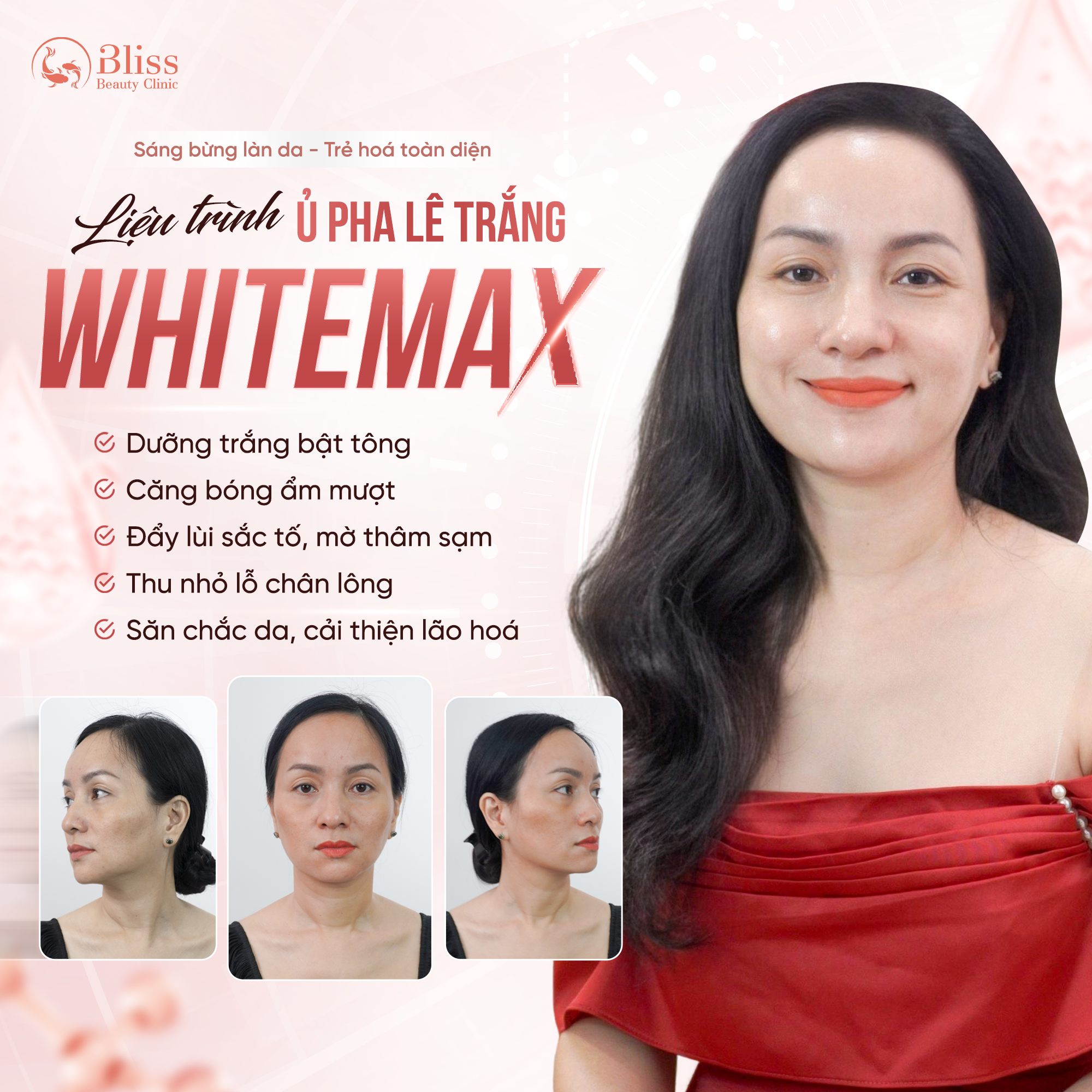 ủ trắng WhiteMax