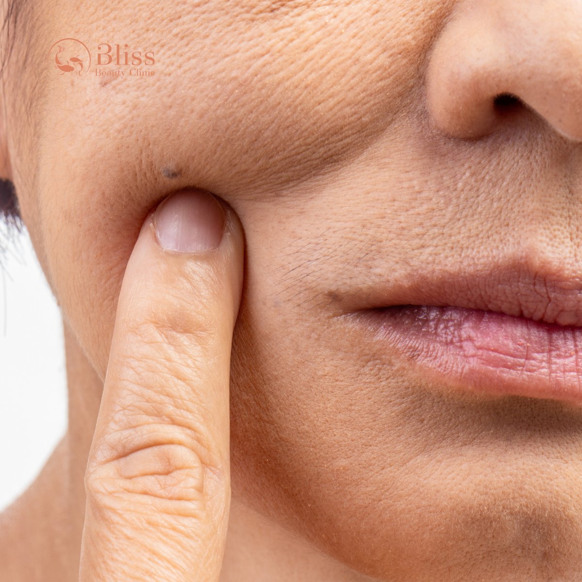 Ứng dụng Hydrigen chống oxy hoá