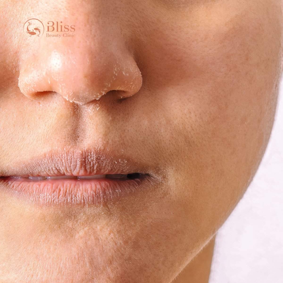 Ứng dụng Hydrigen chống oxy hoá